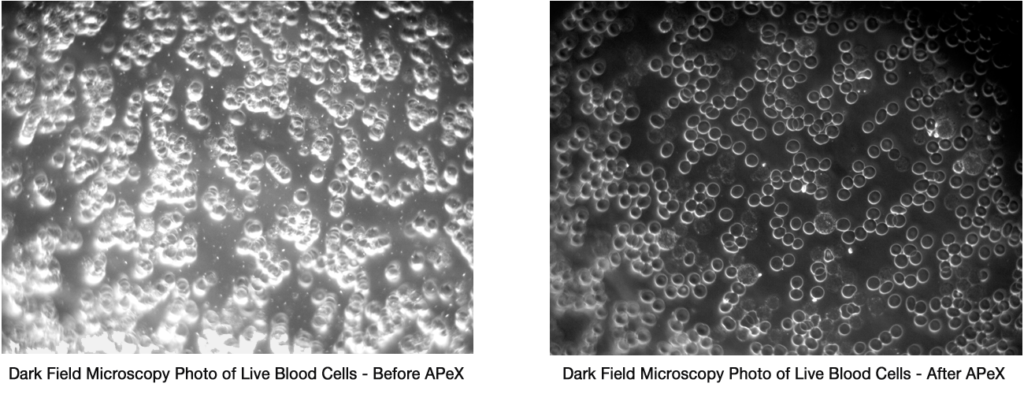 apex, immunity booster, oxygen therapy